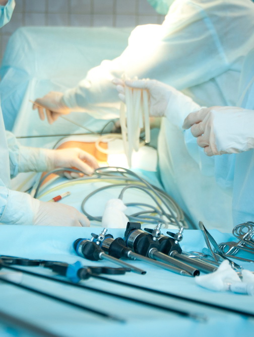 Accesso alle cure, nasce Accademia di chirurgia laparoscopica del colon